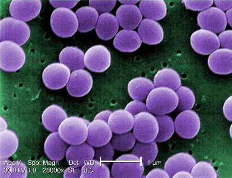 Gambar 3. Bakteri Staphylococcus aureus (CDC/ Matthew J. Arduino, DRPH, 2001). 