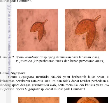 Gambar 3  Spora Gigaspora sp. yang ditemukan pada tanaman inang  