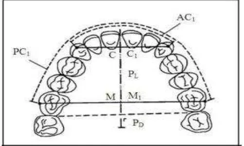 Gambar 2. PL (Palatal Length), PD (Palatal Depth),              C - C1  (Inter  Canine  Distanc),  M-M1   (Inter Molar Distance), AC (Anterior  