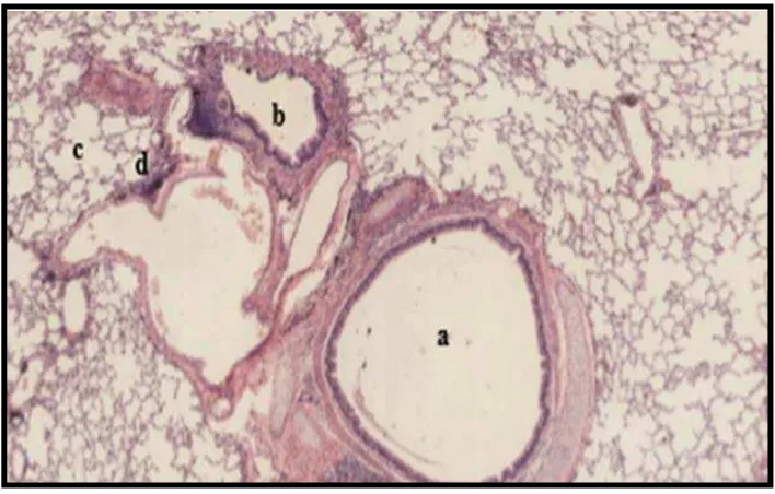 Gambar 4. Gambaran histologik parenkima paru-paru mencit a) bronkus b) bronkiolus, c) bronkiolus respiratorius, d) alveoli (Laelatul    Rahmad, 2013: 22)