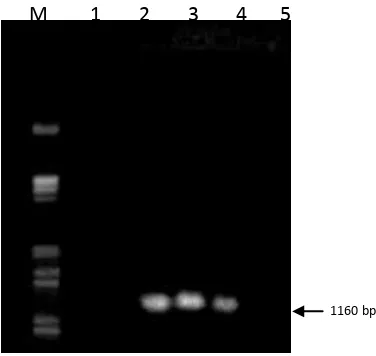 Figure 2 Detection of pathogenic bacteria CVPD (Liberobacter asiaticum) of citrus plants