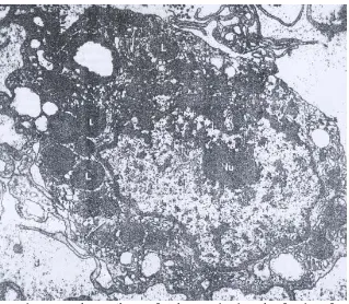 Gambar 1. Struktur mikrograf elektron sebuah makrofag, huruf L adalah lisosom Sekunder yang bersisi materi yang di fagositose 
