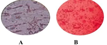 Gambar 1. Hasil pengecatan Gram bakteri Sterptococcus mutans (A) dan (B) Pseudomonas aeruginosa  