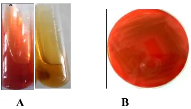 Gambar 2. Hasil uji pada media MSA (A) dan pertumbuhan pada media agar darah (B) 
