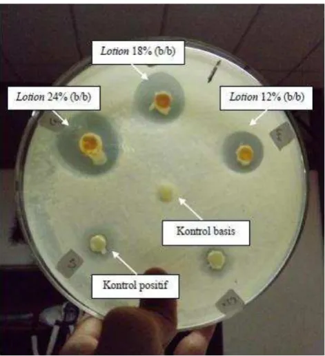 Gambar 1. Sediaan lotion minyak kayu manis (a) konsentrasi 12%, (b) konsentrasi 16% dan (c) konsentrasi 18%  