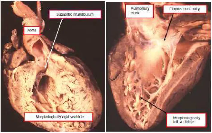 Gambar 1.Gambar 2.