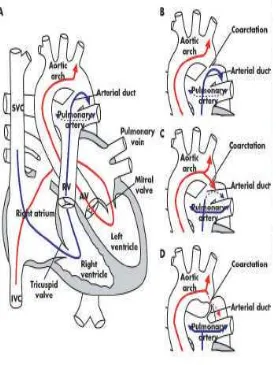 Gambar 2. Diagram Sirkulasi fetusA.Vena cava superior (panah biru) diarahkan melalui katuptrikuspid ke arteri pulmonalis dan melalui duktus arteriosus untuk segmen inferior tubuh (panahmerah) yang mengandung darah yang teroksigenasi melalui plasenta yang d