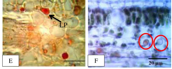 Gambar 2 Hasil uji histokimia pada daun D. fruticosum: senyawa alkaloid (A), kontrol alkaloid (B), terpenoid (C), kontrol terpenoid (D), senyawa lipofil (E), kontrol senyawa lipofil (F): AL) senyawa alkaloid, TP) senyawa terpenoid, LP) senyawa lipofil