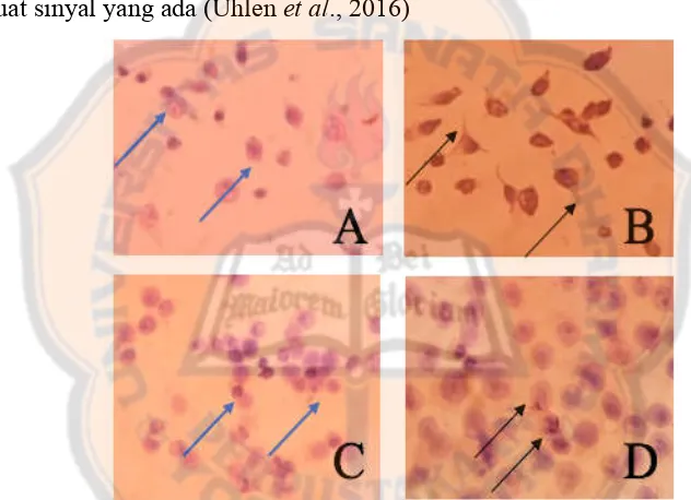 Gambar 4. Efek perlakuan cisplatin dan ekstrak etanol bunga krisan terhadap ekspresi Bcl-2 terhadap sel HeLa dengan perbesaran 400x