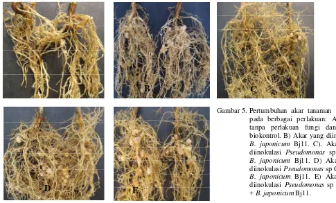 Gambar 5. Pertumbuhan  akar  tanaman   kedelai 