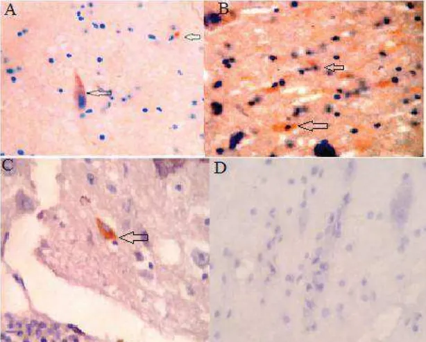 Gambar 3. Antigen virus rabies yang terlacak dengan antibodi monoklonal antiglikopotein padasedian sentuh otak segar terinfeksi