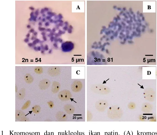 Gambar 1  Kromosom dan nukleolus ikan patin. (A) kromosom diploid, (B) 
