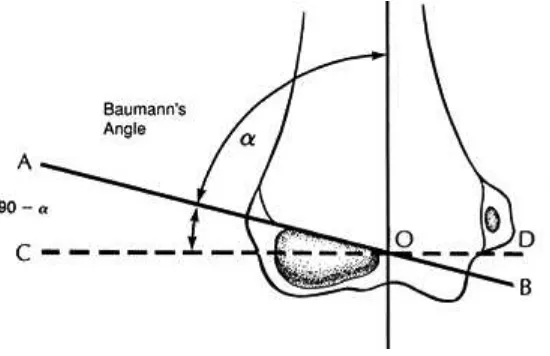Gambar 2.5Baumann’s Angle 