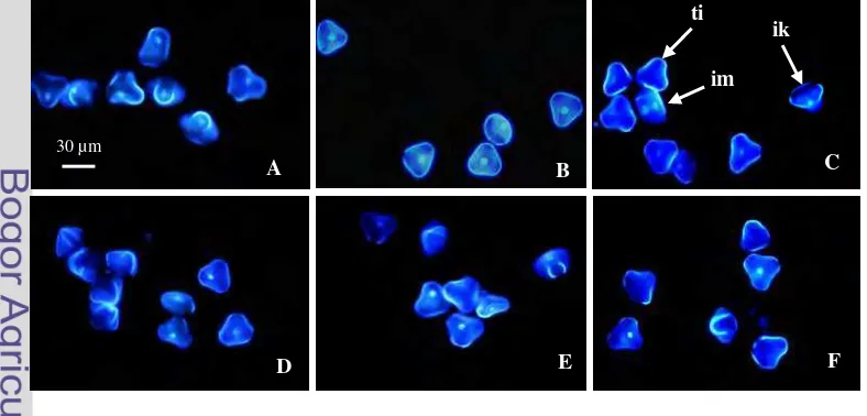 Gambar 2  Perkembangan mikrospora dalam antera pada kultur in vitro. 0 HSK (A), 1 HSK (B), 3 HSK (C), 6 HSK (D), 10 HSK (E) dan 15 HSK (F)