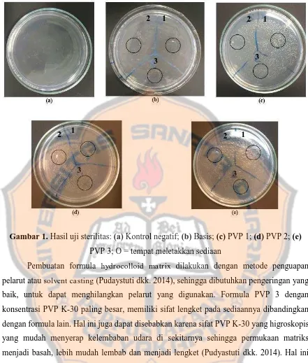 Gambar 1. Hasil uji sterilitas: (a) Kontrol negatif; (b) Basis; (c) PVP 1; (d) PVP 2; (e) 
