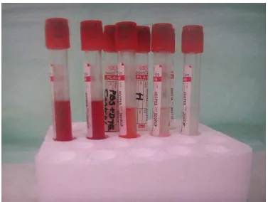 Gambar 11   Bahan injeksi dalam tabung darah steril 