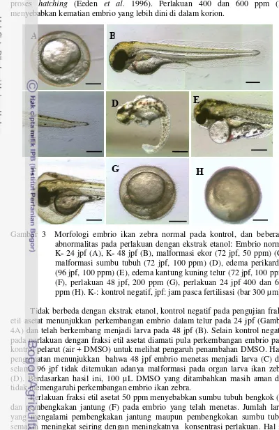 Gambar 3  Morfologi embrio ikan zebra normal pada kontrol, dan beberapa 