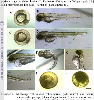 Gambar 4  Morfologi embrio ikan zebra normal pada kontrol, dan beberapa 