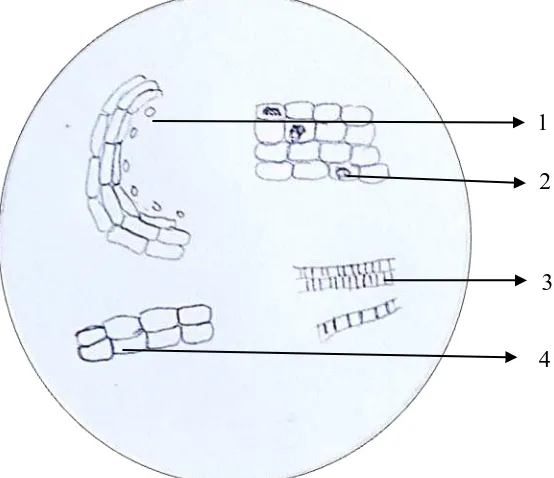 Gambar Gas Chromatograph– Mass Spectrometer Hasil pemeriksaan mikroskopik serbuk simplisia kulit buah  jeruk 