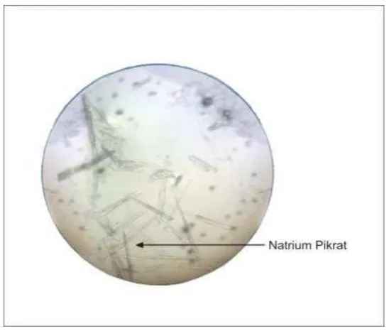 Gambar 3 . Gambar Kristal Kalium pikrat (Perbesaran 10x10)  