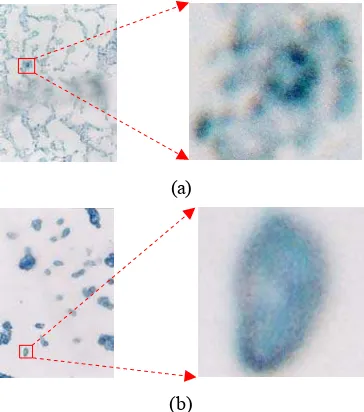 Gambar 11 sel khamir normal :  a. dengan perlakuan dan  b. tanpa perlakuan  