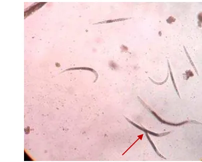 Gambar 2  Nematoda entomopatogen hasil isolasi dari sampel tanah (tanda panah) 