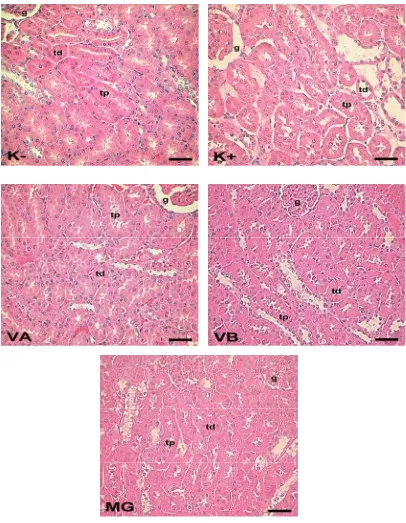 Gambar 1. Fotomikrograf jaringan ginjal tikus perlakuan K- : kontrol negatif ; K+ : kontrol positif (perlakuan diabetes); VA : VCO A (tanpa pemanasan) + perlakuan diabetes; VB : VCO B (pemanasan bertahap) + perlakuan diabetes; MG : minyak goreng + perlakua