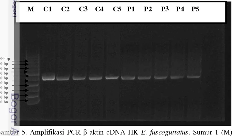 Gambar 5. Amplifikasi PCR β-aktin cDNA HK E. fuscoguttatus. Sumur 1 (M); 
