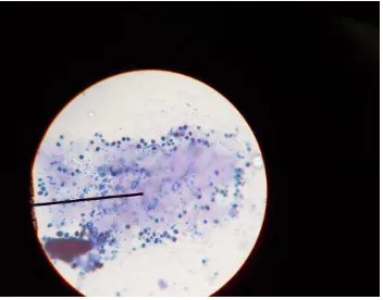Gambar 2.1  Hasil Pemeriksaan Mikroskopis Staphylococcus aureus dan Candida albicans di sekitar cakram Nistatin 