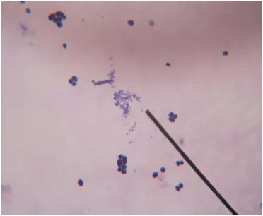 Gambar 4.1 Zona inhibisi di sekitar cakram Kloramfenikol (kanan) dan Nistatin (kiri) 