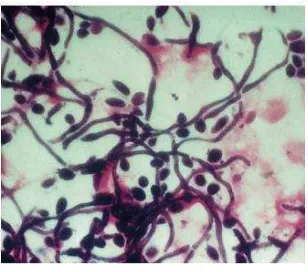 Gambar 1 : Blastospora dan hifa membentuk Kandida (Samaranayake, 2012). 