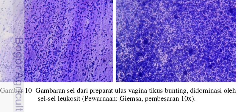 Gambar 9   Sperma diantara sel-sel keratin dan leukosit setelah proses 