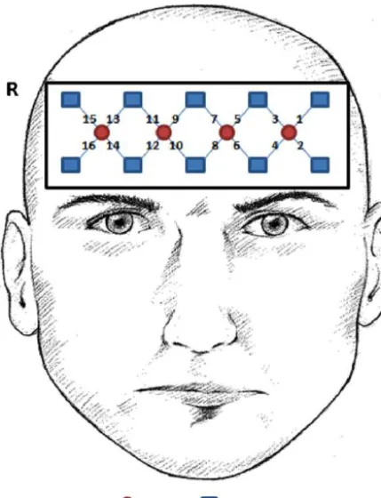 Fig.and 1. The fNIR machine utilized in this study included a head-piece with sources photoreceptors to measure activity in brain frontal regions.