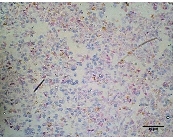 Gambar 5 Pewarnaan ZN tidak menunjukkan hasil positif pada organ limpa burung Elang Jawa, bar 40 µm 