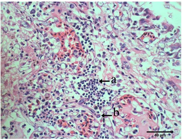 Gambar 6  Organ paru-paru burung Elang Jawa mengalami kongesti (panah) dengan pewarnaan HE, bar 100 µm  
