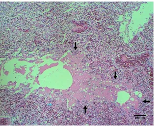 Gambar 8 Hifa jamur (panah a) dan koloni bakteri (panah b) di organ paru-paru burung Elang Jawa dengan pewarnaan HE, bar 40 µm 