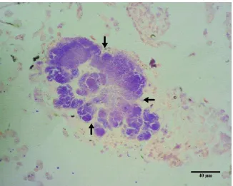 Gambar 11 Kumpulan hifa jamur (panah) di organ paru -paru burung Elang Jawa terwarnai positif dengan pewarnaan PAS, bar 40 µm 