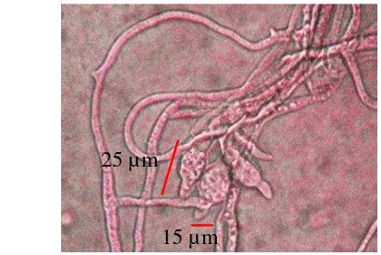 Gambar 3  Mikroskopis konidia P.oryzae dengan perbesaran 40x10  