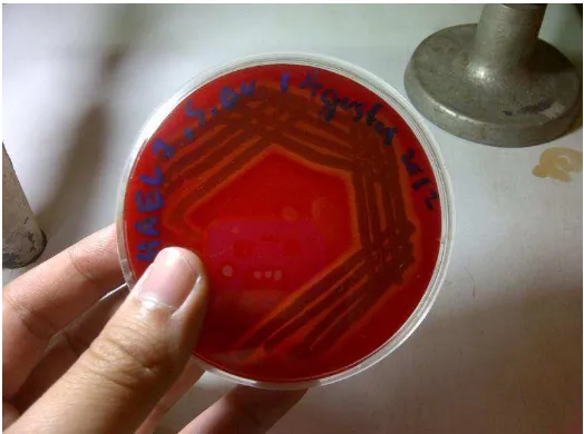 Gambar 2.1 Koloni Staphylococcus aureus pada Manitol Salt Agar (MSA) 