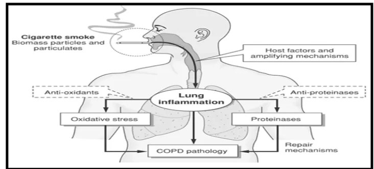 Gambar 2.1. Patogenesis COPD (PDPI, 2010). 