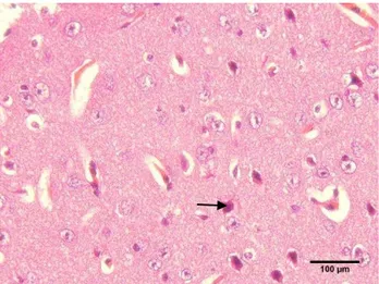 Gambar  10    Histopatologi  otak  marmut  pada  usia  tua  kastrasi  tiga  bulan  pada  daerah korteks