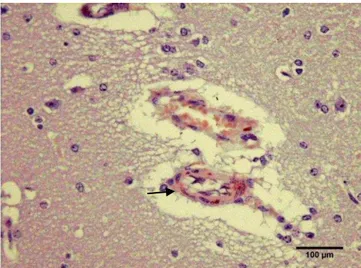 Gambar  13  Histopatologi  otak  marmut  usia  tua  dengan  kastrasi  tiga  bulan  pada  korteks