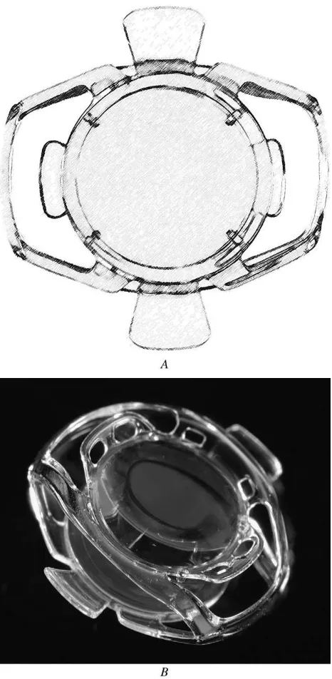 Figure 2. A: Schematic of the anterior surface of the Synchrony dual-optic