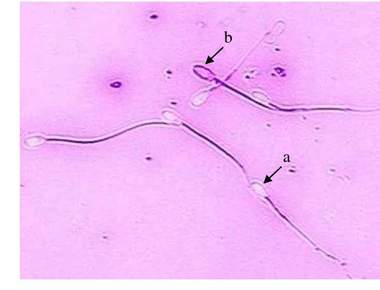 Gambar  2 Spermatozoa 