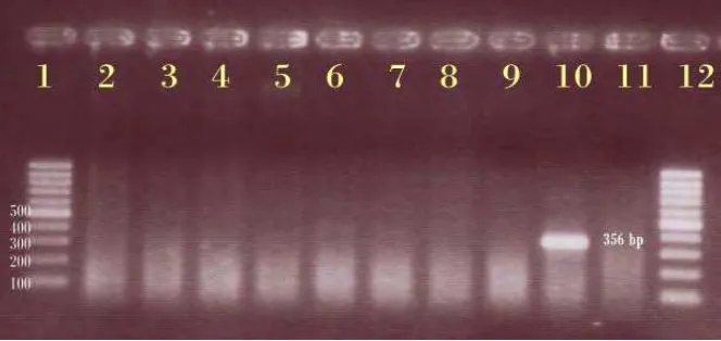 Gambar 2 Hasil PCR konvensional untuk mengetahui spesifisitas primer IS900. Primer IS900 tidak mengamplifikasi pita DNA dari E