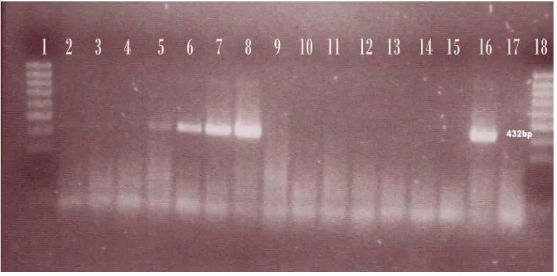 Gambar 3 Hasil PCR konvensional untuk mengetahui sensitivitas primer IS900. (A) Pita DNA MAP terdeteksi pada pengenceran 104-10 sel/ml (kolom 7 6-9), dan tidak terdeteksi pada pengenceran 100-10 sel/ml (kolom 2-3 5), kontrol positif MAP (kolom 10), blanko 