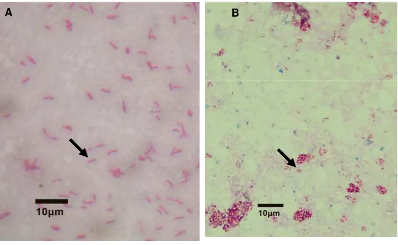 Gambar 6 Perbandingan Mycobacterium sp. isolat F56 dan MAP referensi. Isolat F56 (A) lebih besar daripada isolat MAP referensi (B).Perbesaran 4000X, tanda panah menunjukkan bakteri yang dimaksud