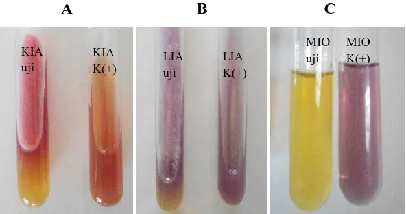Gambar 4. Hasil Uji Identifikasi Bakteri S. sonnei ATCC 9290 pada Media KIA (A), LIA (B), dan MIO (C) 