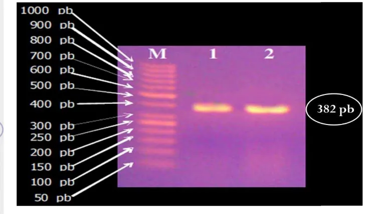Gambar 8 Hasil elektrophoresis dari PCR koloni. M = Marker (1000 pb), 1 dan 2 