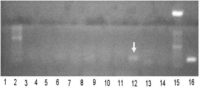 Gambar 5. Hasil elektroforesis produk RT-PCR dengan primer H5: FH5; RH5 (Lee & Suarez 2004) pada 55 bp    